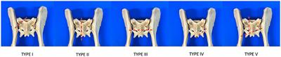 External Fixation for Fracture Stabilization of the Sacrum in 15 Dogs